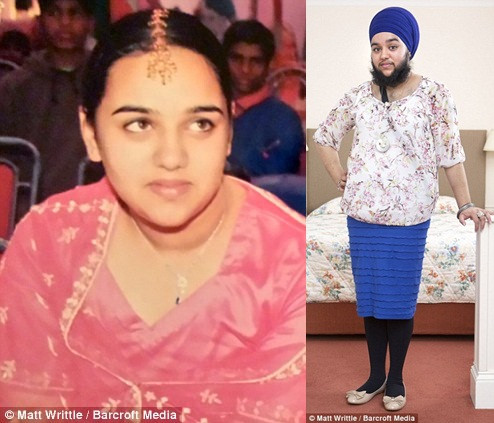 Cô gái muốn tự tử vì... mọc râu quai nón ảnh 2