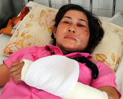 Chị Nguyễn Thị Tâm tại bệnh viện.