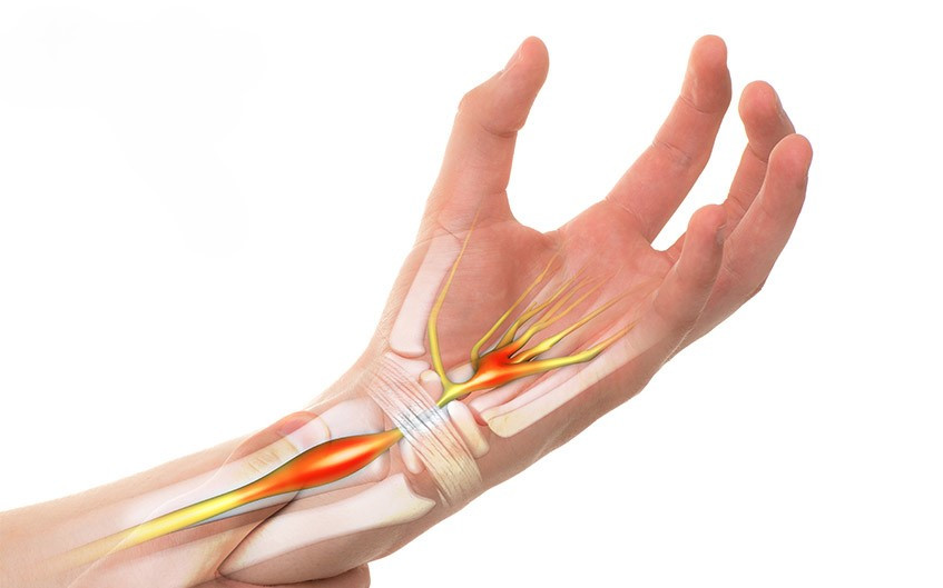 Dây thun khi bắn vào vị trí dây thần kinh đi qua có thể gây ra những tổn thương nghiêm trọng như tình trạng tê bì, đau nhức hoặc thậm chí mất cảm giác ở tay. Dây thun khi bắn vào vị trí dây thần kinh đi qua có thể gây ra những tổn thương nghiêm trọng như tình trạng tê bì, đau nhức hoặc thậm chí mất cảm giác ở tay.