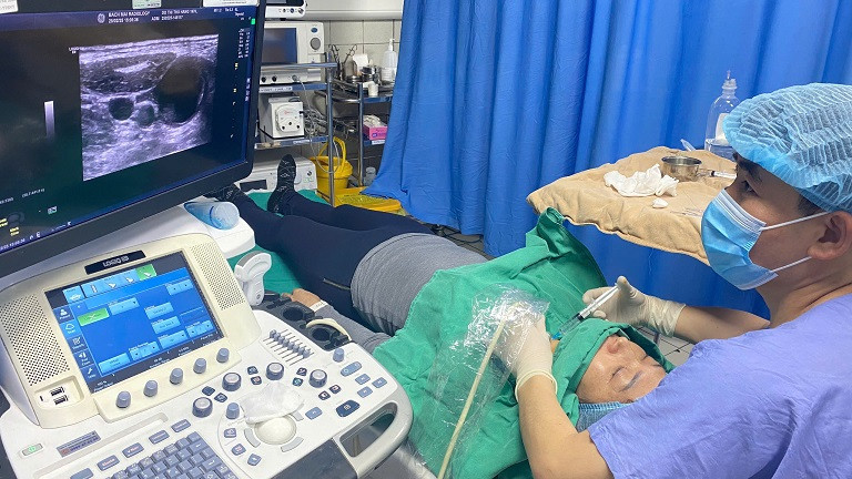 Bác sĩ thực hiện kỹ thuật tiêm cồn tuyến giáp cho bệnh nhân. Ảnh: Bệnh viện Bạch Mai
