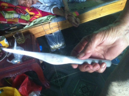 Con dao ông dùng để tự mổ