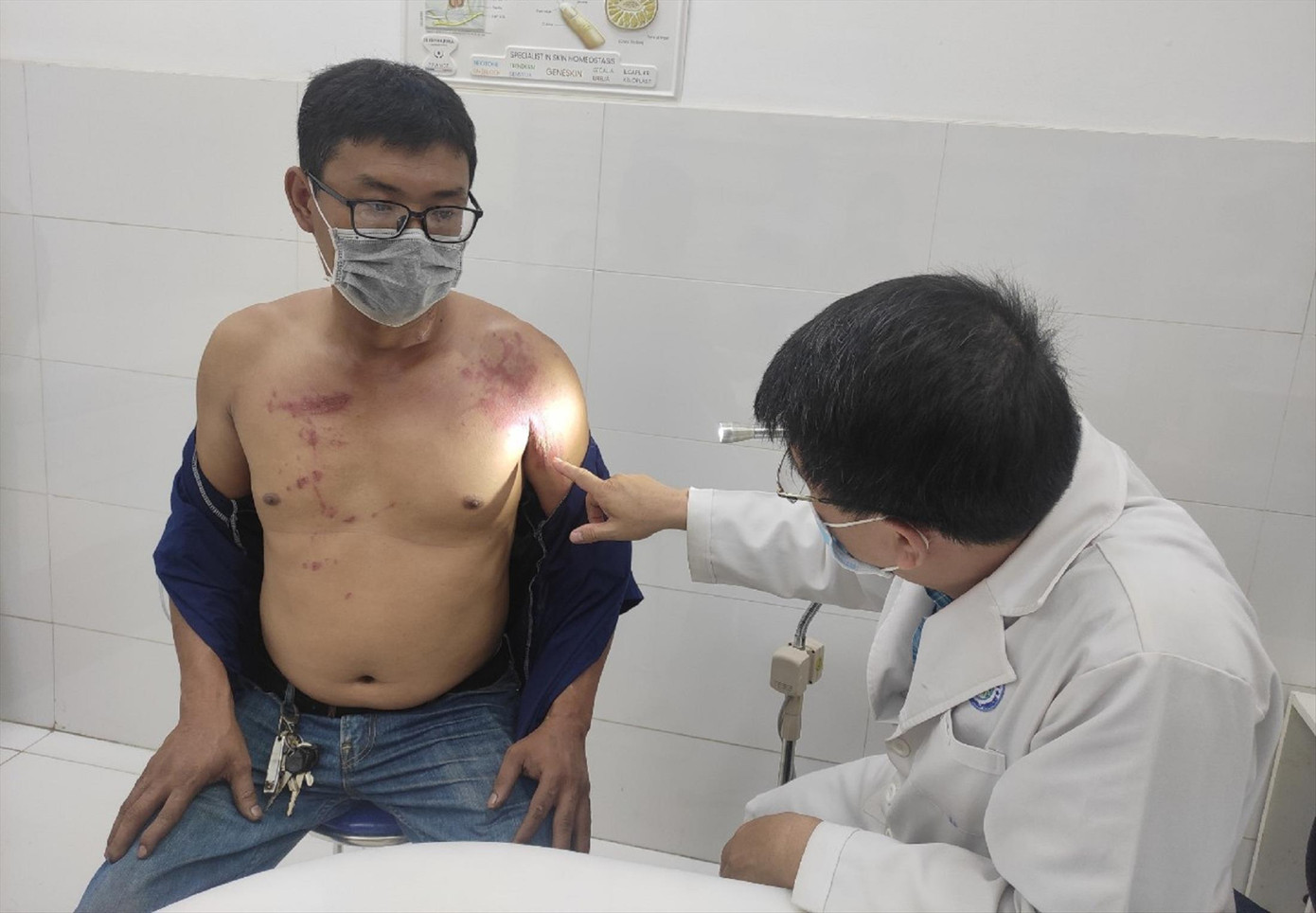 Nam bệnh nhân ngụ tại huyện Bình Chánh bị tổn thương da do tiếp xúc với kiến ba khoang