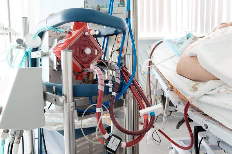 Hệ thống ECMO (tim, phổi nhân tạo) giảm nguy cơ tử vong cho bệnh nhân