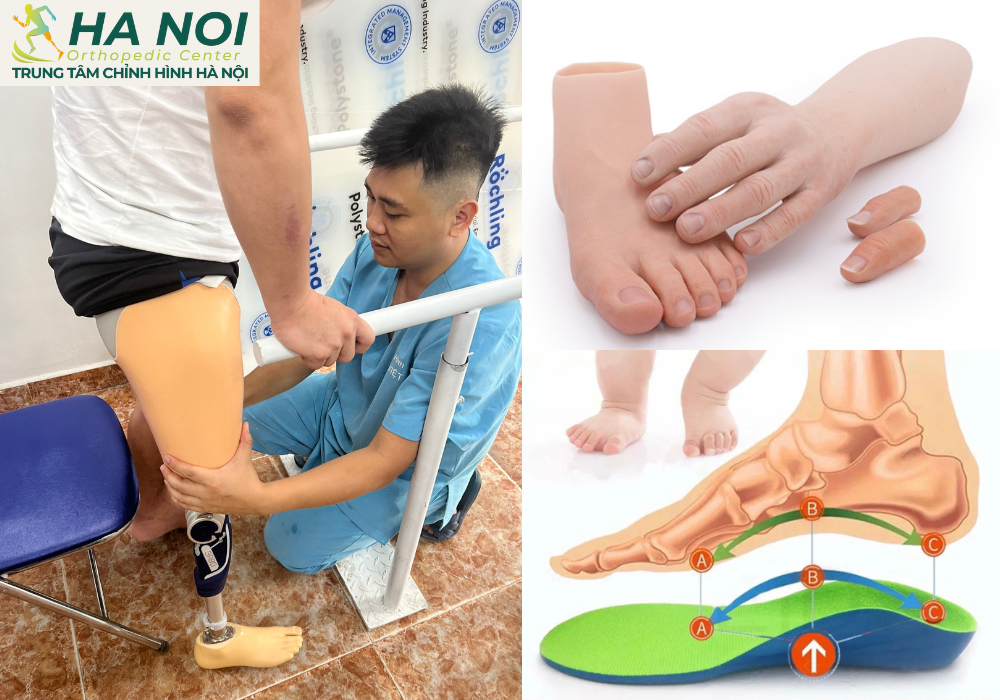 Hình ảnh bệnh nhân tại Trung tâm chỉnh hình Hà Nội Hình ảnh bệnh nhân tại Trung tâm chỉnh hình Hà Nội