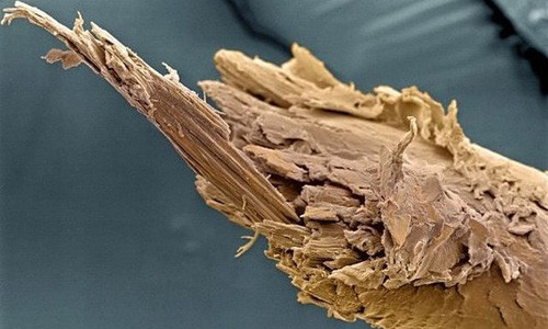 Các tế bào máu đỏ. Những tế bào này có nhiệm vụ cung cấp oxy cho cơ thể. Các tế bào máu đỏ. Những tế bào này có nhiệm vụ cung cấp oxy cho cơ thể