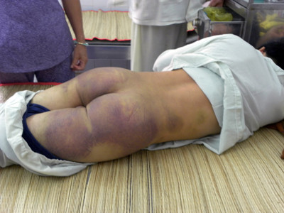 Ông Tánh trong bệnh viện với nhiều vết thương. Ảnh: VN