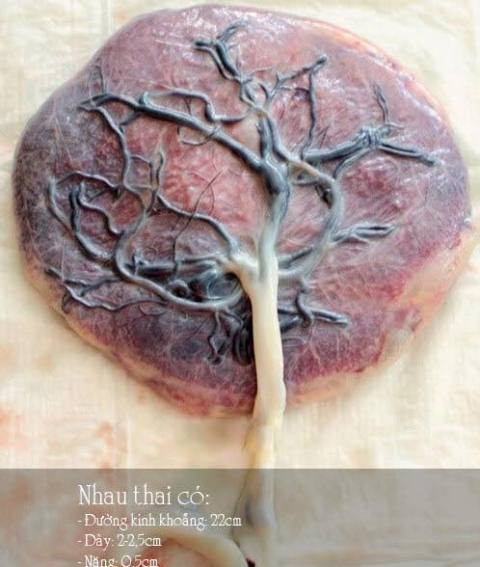 Thuốc làm từ nhau thai người: Đại bổ hay độc hại? ảnh 1