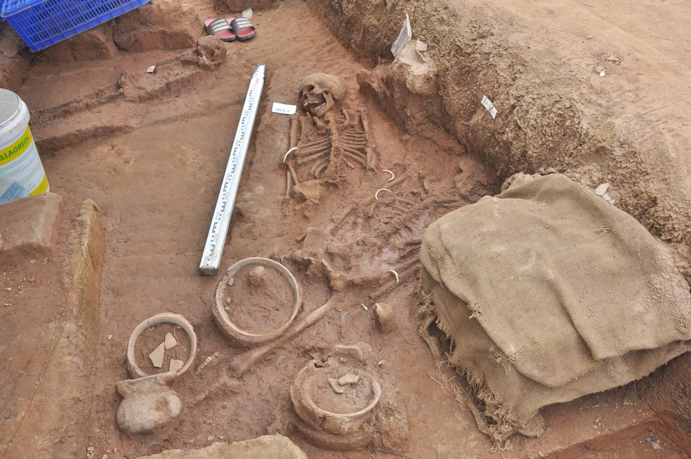 Mộ táng, di cốt và dấu vết của tục nhổ răng cửa trên di cốt tiền Đông Sơn.