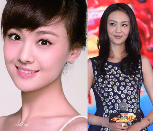 Diễn viên sinh năm 1991 Trịnh Sảng mới đây thừa nhận đã phẫu thuật thẩm mỹ. Nhiều người tiếc vì gương mặt cô giờ đây (ảnh phải) không trong trẻo như trước