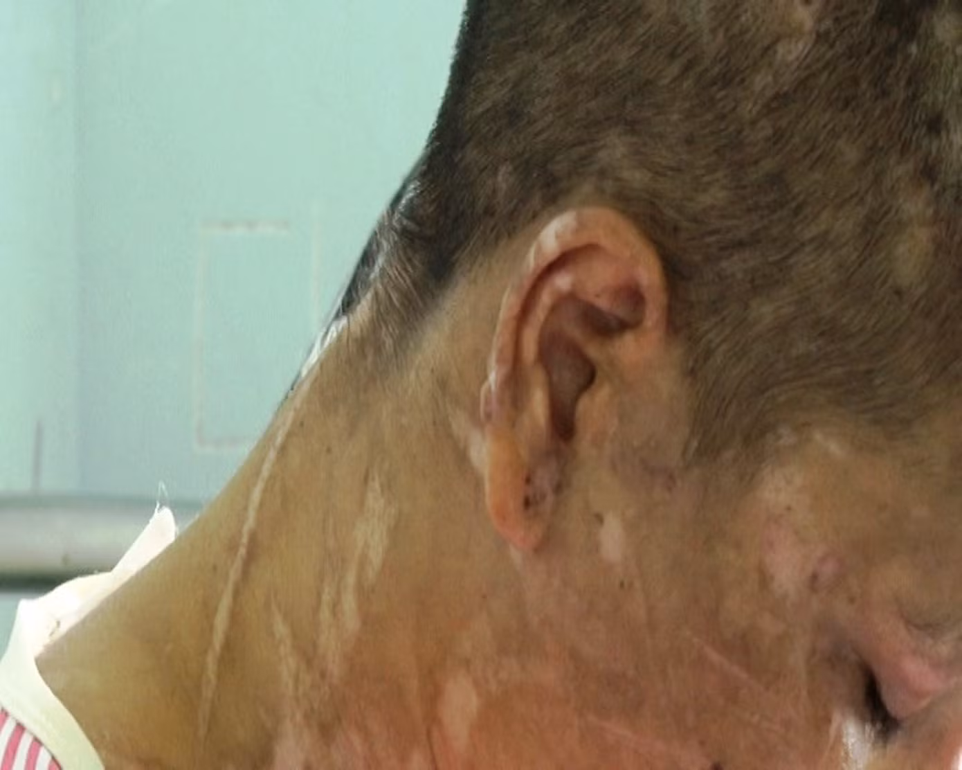 Tin mới nhất vụ nữ giúp việc 9X bị chủ tra tấn như thời trung cổ ảnh 7