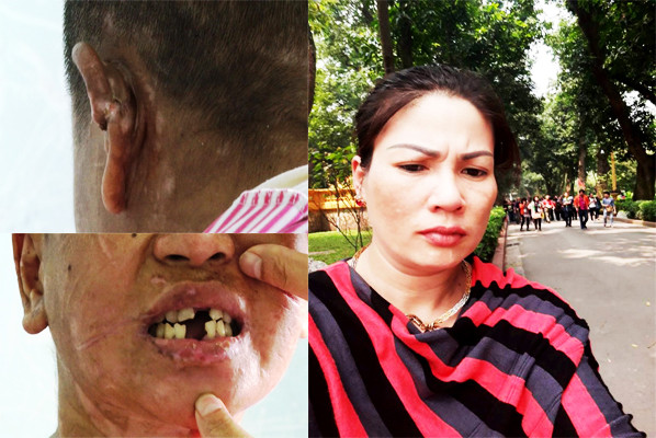 Không phải bà Hà bẻ răng, cắt tai Y Nhiêu thì ai đã làm việc này ?.