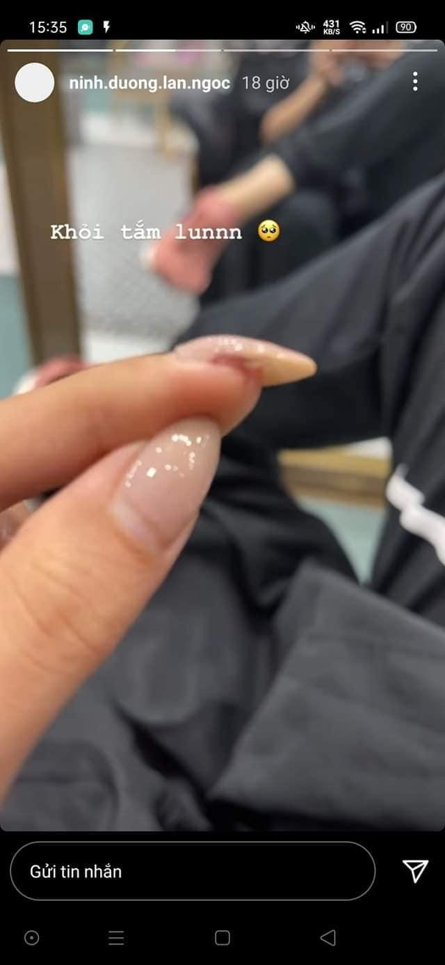 Ninh Dương Lan Ngọc bị "lật móng tay" khi quay xong khiến khán giả nhìn thôi mà cùng thấy "thốn" cho nữ nghệ sĩ.