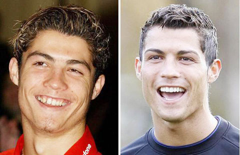 Cấm bồ nâng ngực, Ronaldo lại nhờ dao kéo ảnh 3