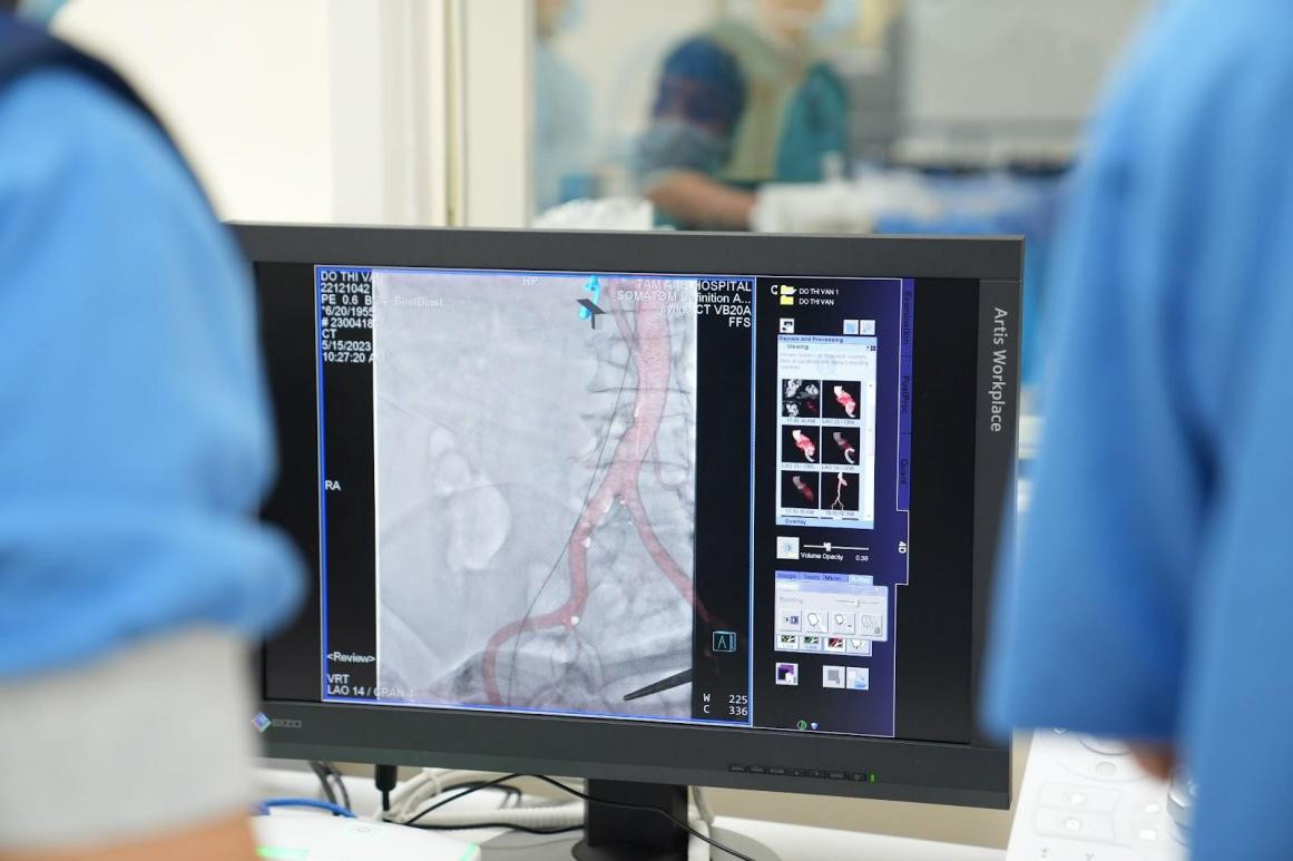 Hệ thống chụp mạch máu xóa nền giúp các bác sĩ thực hiện can thiệp chuẩn xác cho kết quả tối ưu. Ảnh: BVĐK Tâm Anh Hệ thống chụp mạch máu xóa nền giúp các bác sĩ thực hiện can thiệp chuẩn xác cho kết quả tối ưu. Ảnh: BVĐK Tâm Anh