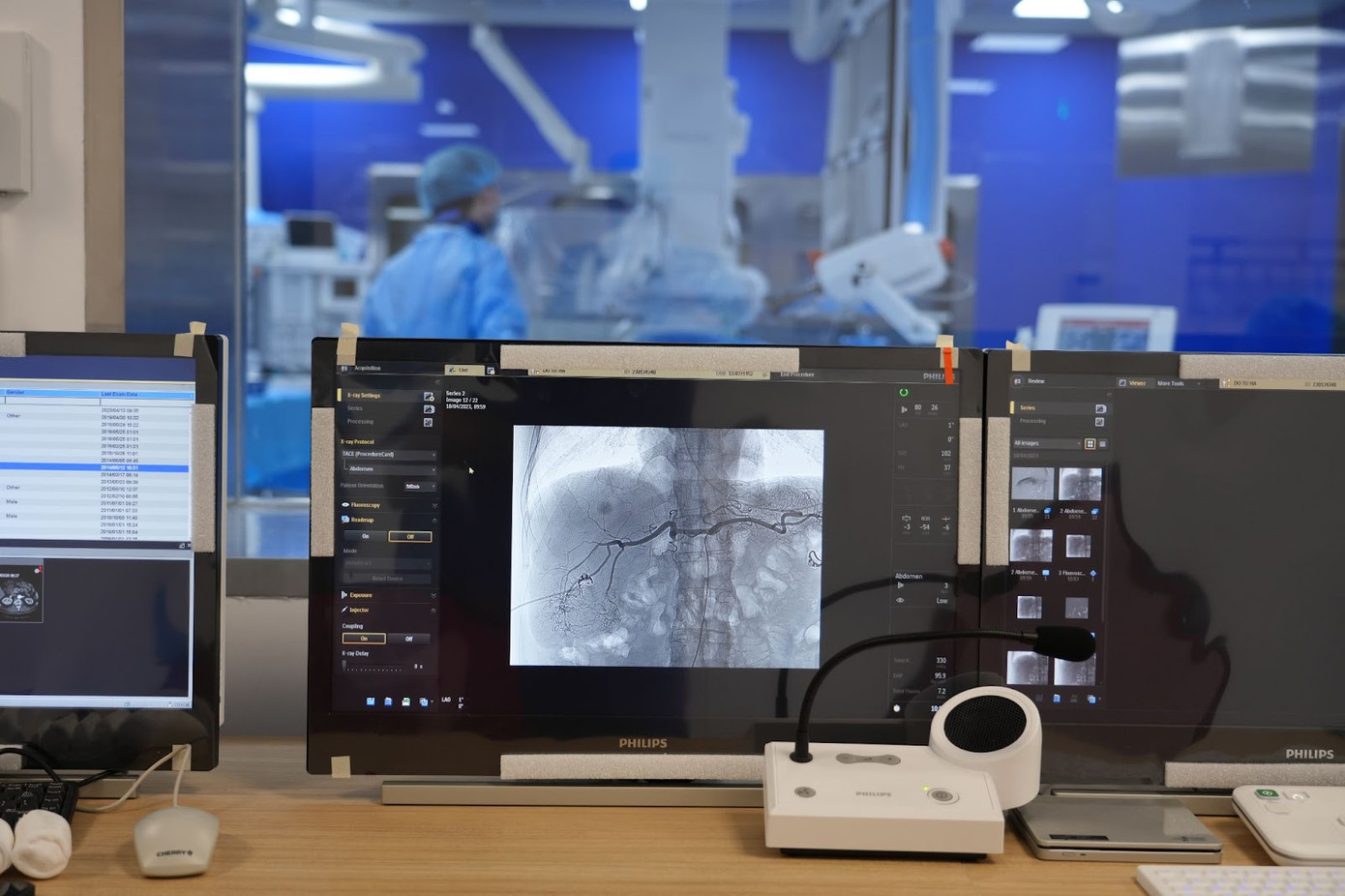 Nút mạch điều trị ung thư gan tại BV Hồng Ngọc