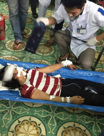 Cuộc sống địa ngục của người phụ nữ bị chồng cắt gân vì đòi ly hôn ảnh 3