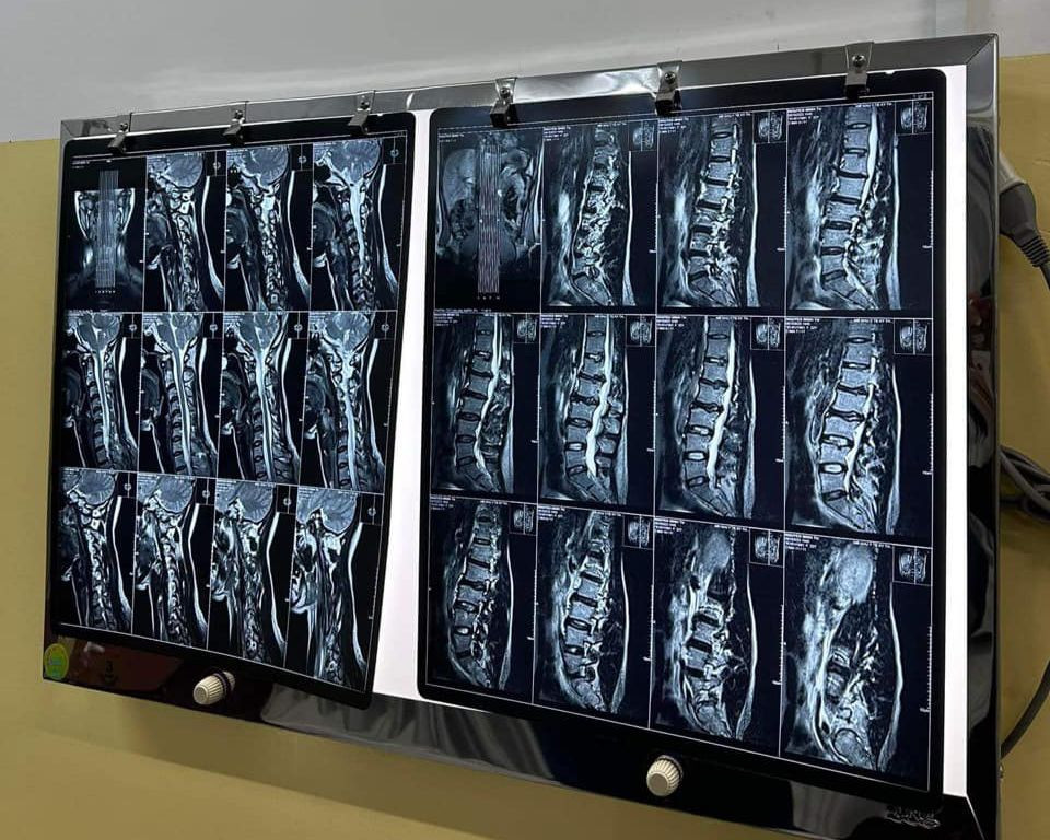 Minh Tú chia sẻ tình trạng sức khỏe đáng báo động trên Facebook cá nhân. Minh Tú chia sẻ tình trạng sức khỏe đáng báo động trên Facebook cá nhân.