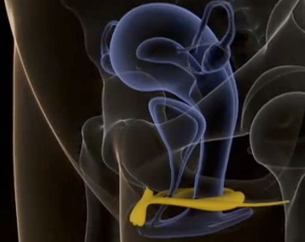 Hình ảnh âm vật (clitoris) do GS. Helen O’Connell, chuyên gia tiết niệu nổi tiếng Australia thực hiện với sự trợ giúp của thiết bị cộng hưởng từ, 1998.