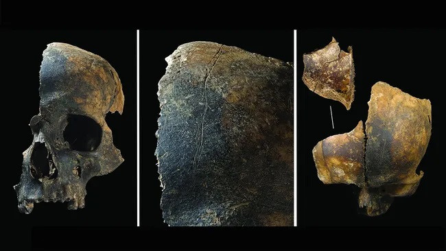 Xương sọ từ địa điểm khảo cổ Charterhouse Warren ở Anh cho thấy bằng chứng về những vết thương chí mạng cách đây 4.000 năm. (Ảnh: Schulting et al., Antiquity) Xương sọ từ địa điểm khảo cổ Charterhouse Warren ở Anh cho thấy bằng chứng về những vết thương chí mạng cách đây 4.000 năm. (Ảnh: Schulting et al., Antiquity)