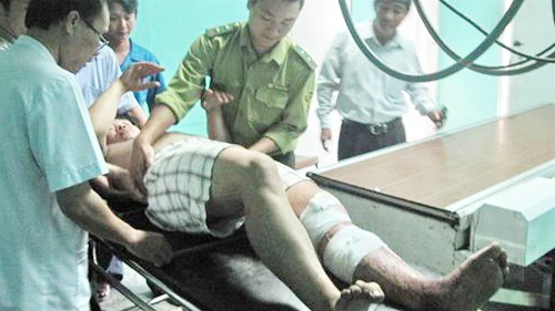 Đến sáng nay 28-7, anh Quế vẫn rất đau đớn với nhiều vết thương trên thân thể