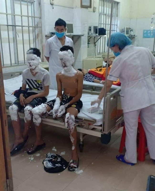 Nạn nhân của pháo nổ tự chế.