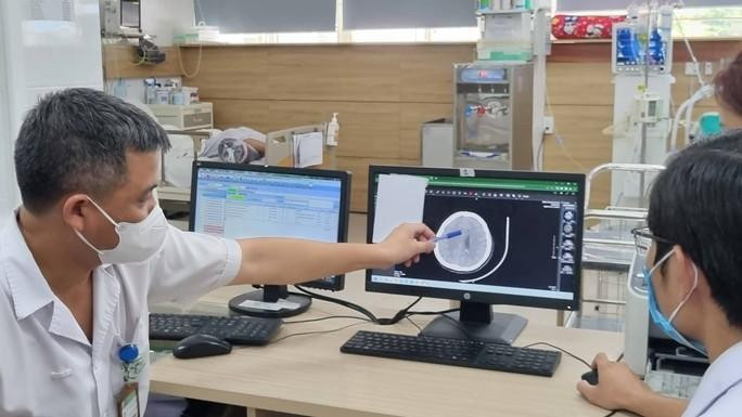 Não bệnh nhân bị tổn thương sau khi hút thuốc lá điện tử chứa ma túy. (Ảnh: Bệnh viện cung cấp cho báo chí)