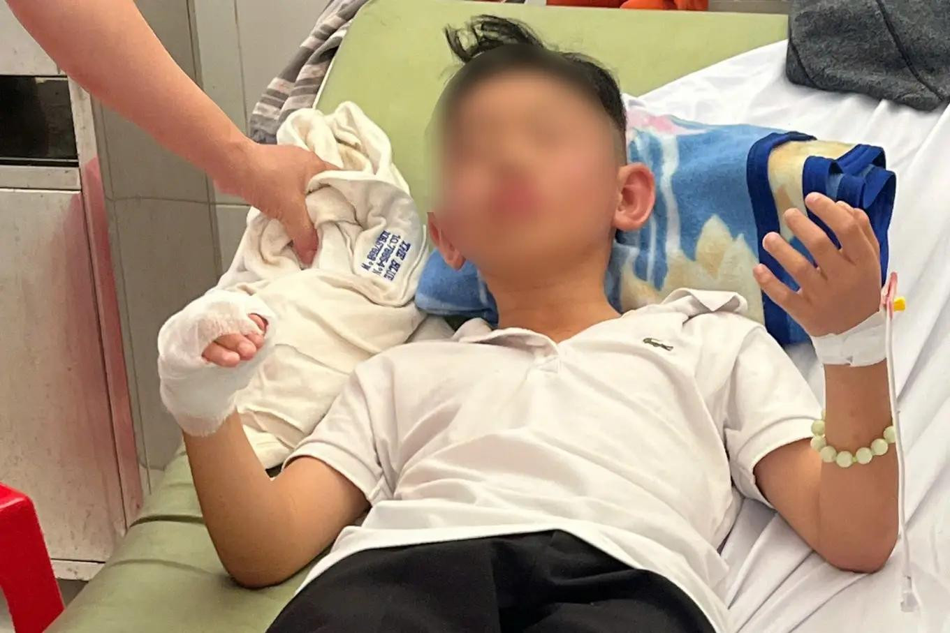 Một học sinh bị bỏng đang được cấp cứu tại bệnh viện. (Ảnh: T.B.) Một học sinh bị bỏng đang được cấp cứu tại bệnh viện. (Ảnh: T.B.)