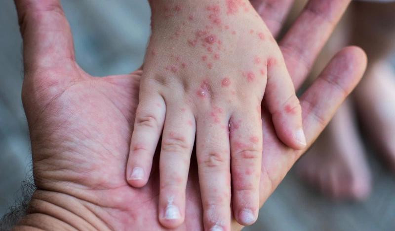 (Ảnh minh họa từ Internet)