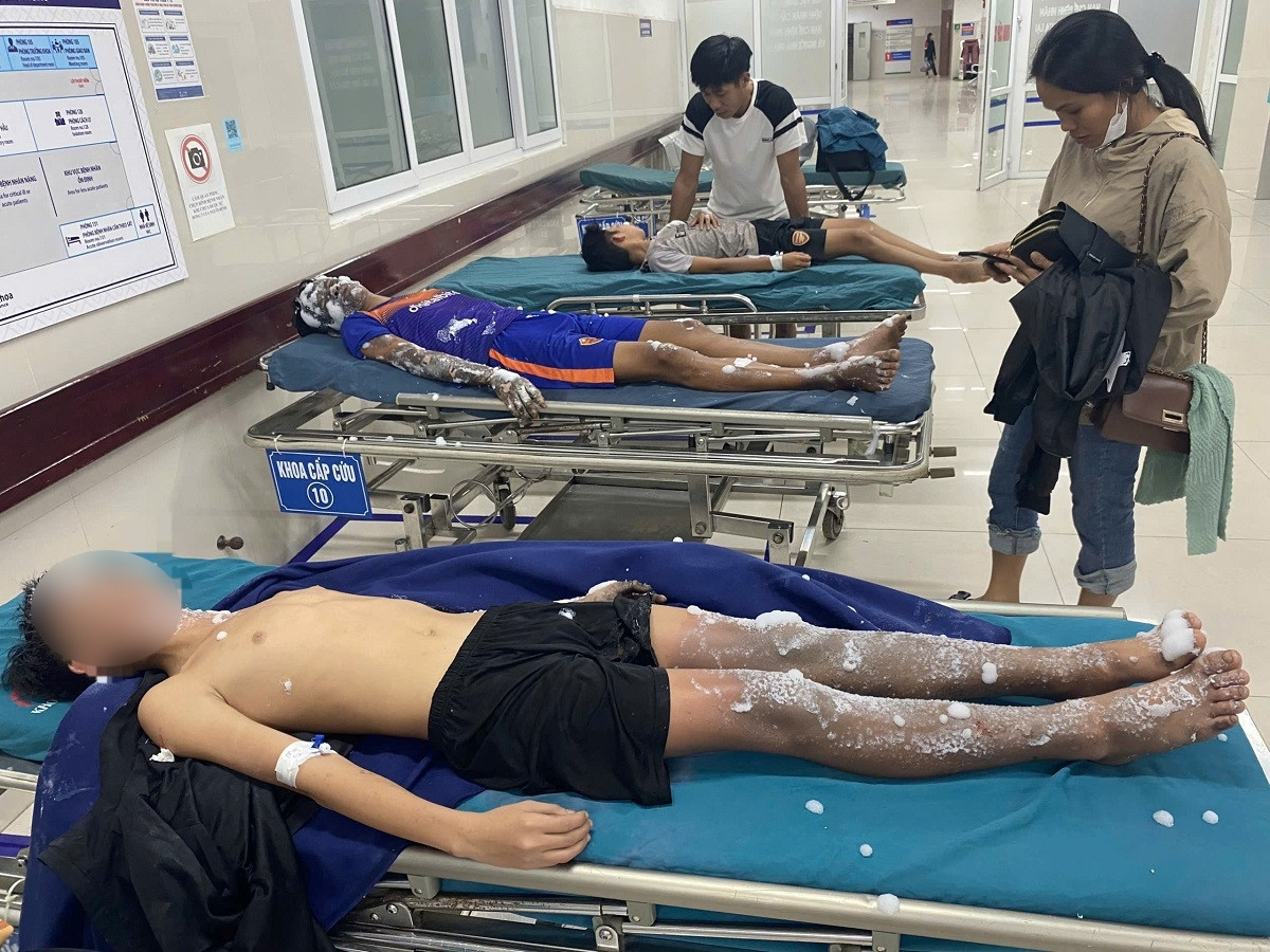 Nhóm học sinh bị bỏng phải nhập viện cấp cứu. (Ảnh: Bệnh viện cung cấp cho báo chí)