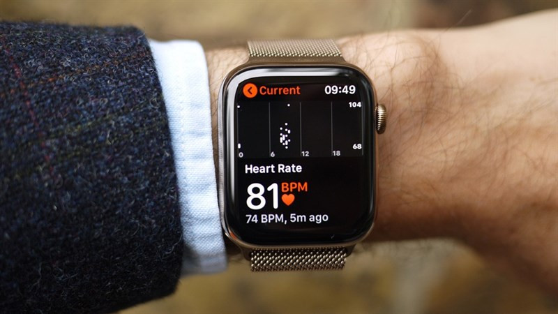 Apple Watch của Kimmie Watkins đã phát hiện nhịp tim cao bất thường của cô. (Ảnh: Wearable)