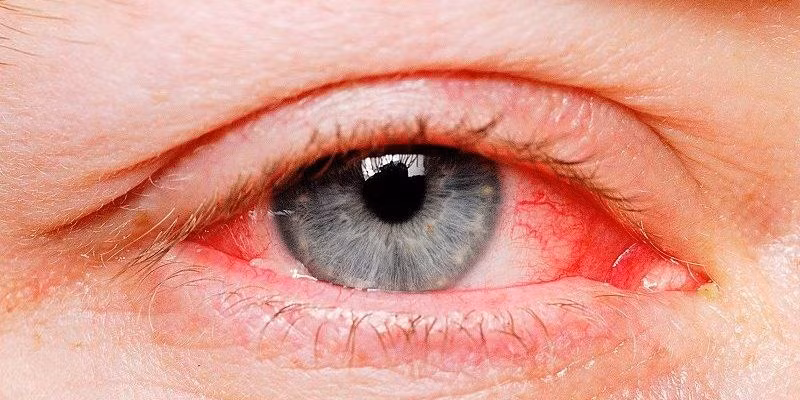 (Ảnh minh hoạ từ Internet)