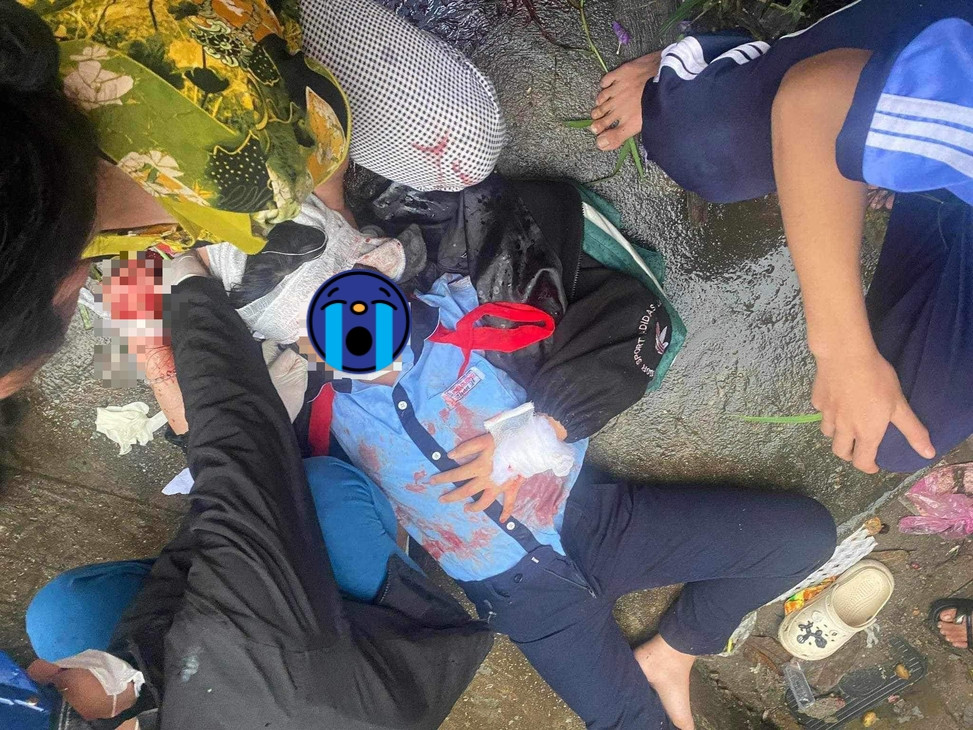 Hiện trường nữ sinh lớp 6 ở Huế bị tấn công đến chấn thương sọ não.