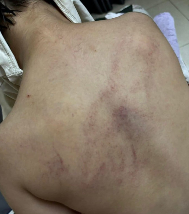 Hà Nội khẩn trương xác minh việc trẻ mầm non nghi bị giáo viên Trường Mầm non Gia Thụy bạo hành.