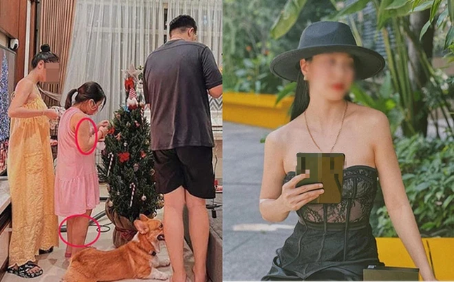 Bé V.A. (mặc váy hồng). Bé V.A. (mặc váy hồng).