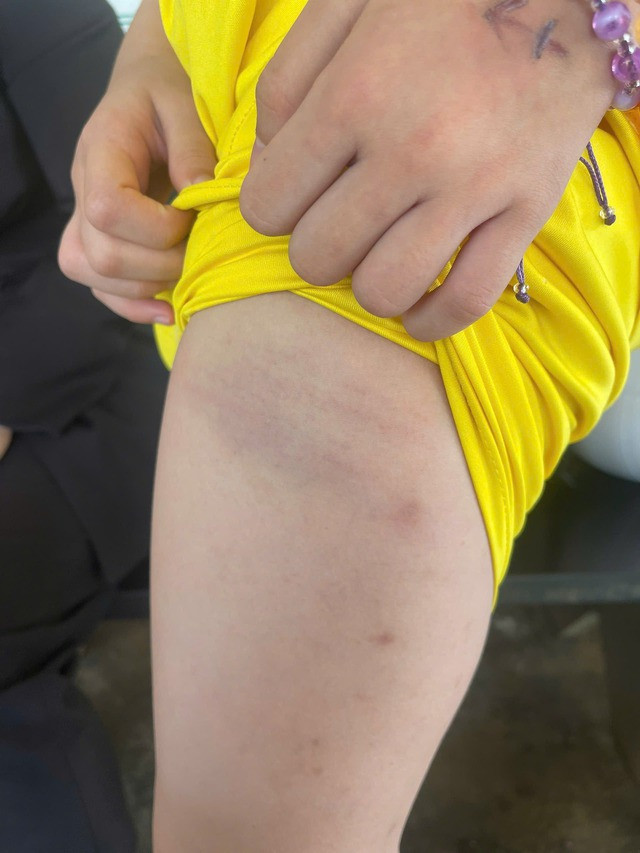 Hình ảnh đăng tải cùng bài viết &quot;tố&quot; cô giáo đánh học sinh.