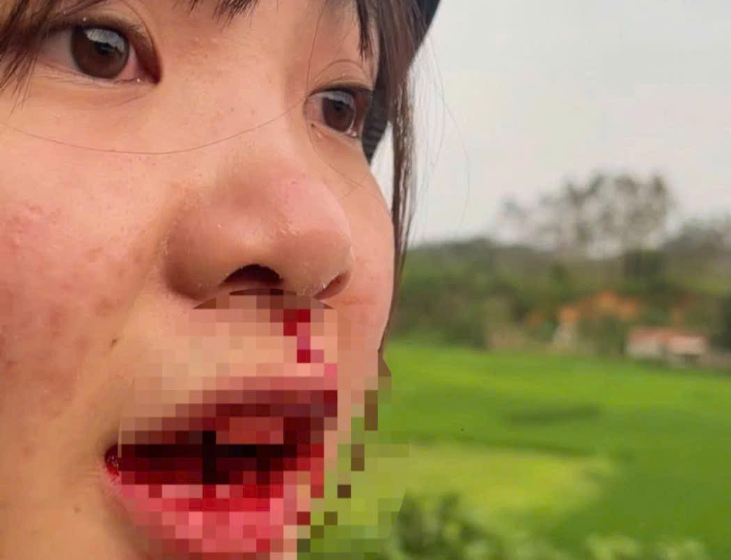 Hình ảnh cô gái trẻ bị chảy máu miệng sau vụ việc được lan truyền trên MXH. (Ảnh cắt từ clip)
