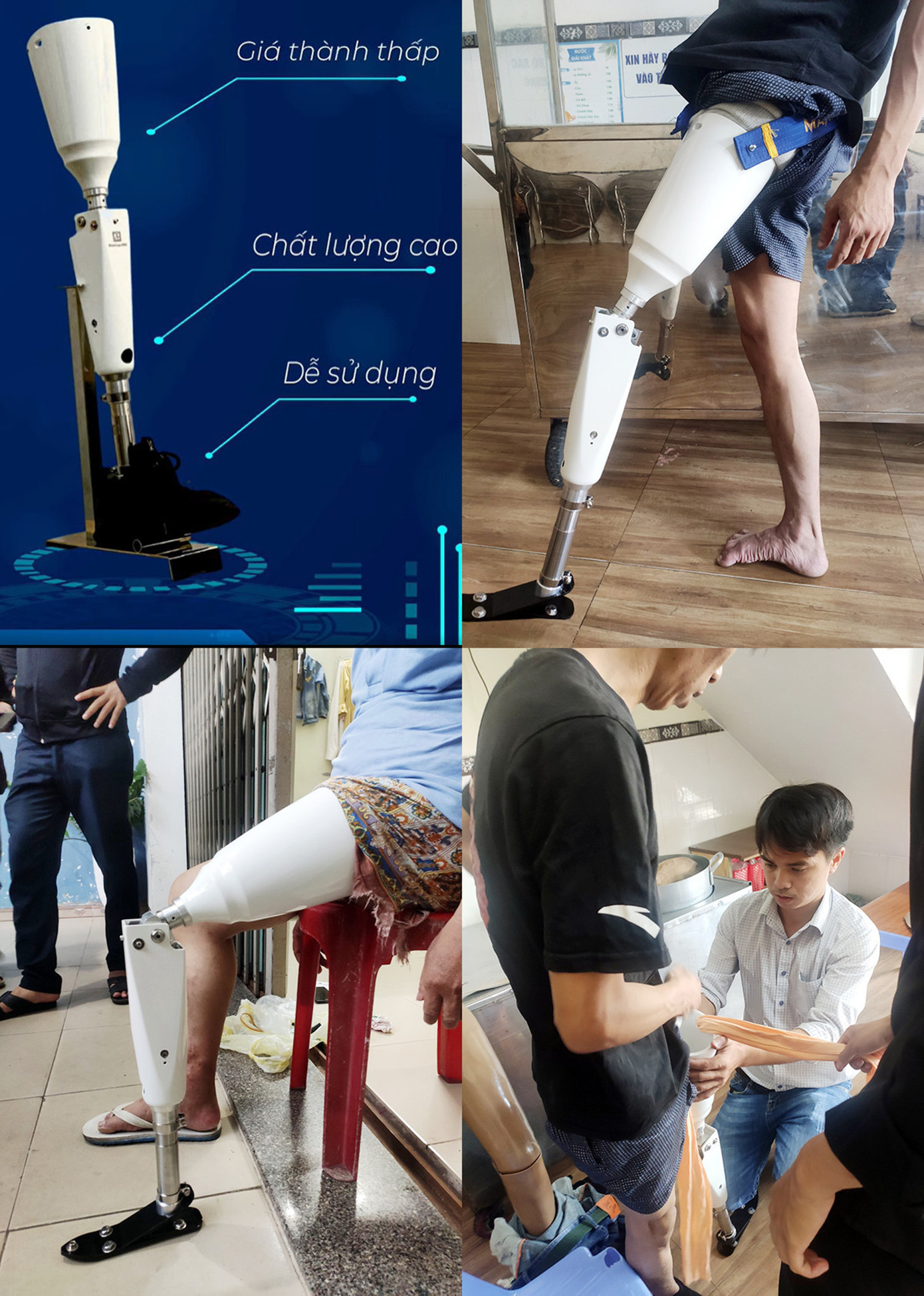 Những người khuyết tật sử dụng thử sản phẩm “Chân giả chủ động” của ĐH Duy Tân