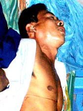 Hung thủ Nguyễn Hoàng Trung khi được đưa đến bệnh viện cấp cứu.