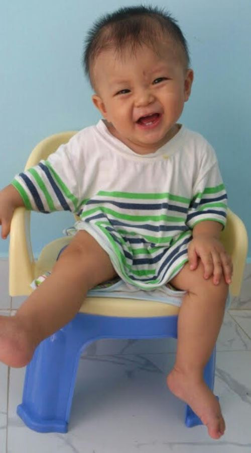 Cậu bé bị đâm xuyên não khỏe mạnh đón thôi nôi ảnh 4