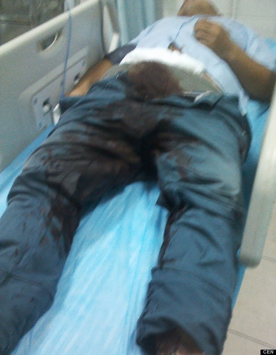 Buồn chán vì không có bạn gái, Yang Hu quyết định cắt đi 