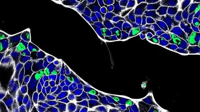 Vi khuẩn gây bệnh chlamydia ở người có thể lây nhiễm các tế bào trong ruột, được mô tả ở độ phân giải cao. Các vi khuẩn này được hiển thị màu xanh lá cây. (Ảnh: Pargev Hovhannisyan, Đại học Würzburg, CC-BY 4.0) Vi khuẩn gây bệnh chlamydia ở người có thể lây nhiễm các tế bào trong ruột, được mô tả ở độ phân giải cao. Các vi khuẩn này được hiển thị màu xanh lá cây. (Ảnh: Pargev Hovhannisyan, Đại học Würzburg, CC-BY 4.0)