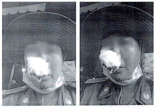 Hình ảnh bà T. bị đánh gây thương tích. Ảnh: Công ty TNHH MTV Dịch vụ công ích Thanh niên xung phong cung cấp. Hình ảnh bà T. bị đánh gây thương tích. Ảnh: Công ty TNHH MTV Dịch vụ công ích Thanh niên xung phong cung cấp.