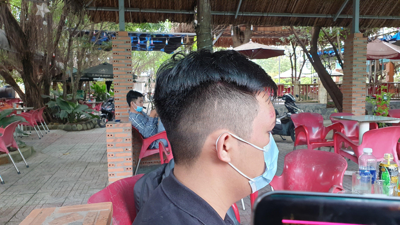 Vết thương ở vùng trán anh K. do các đối tượng lạ mặt gây ra.