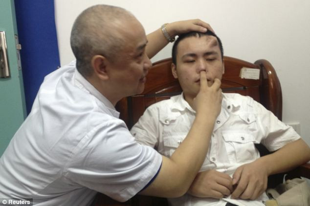 Bác sĩ đang kiểm tra chiếc mũi