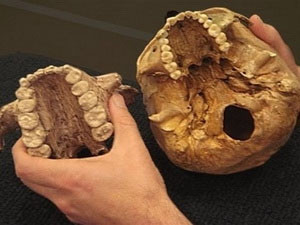 Hàm răng lớn của người nguyên thủy Paranthropus boisei. Nguồn: AP