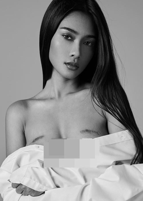 Thuzar Wint Lwin chia sẻ: “Điều gì sẽ xảy ra nếu tôi không biết về những khối u đó. Chuyện gì sẽ đến nếu các tế bào ung thư phát triển, di căn và quá muộn để điều trị? Vết sẹo nhắc nhở tôi rằng tôi còn sống sót và phải luôn ý thức với những thay đổi xảy ra trong cơ thể mình".