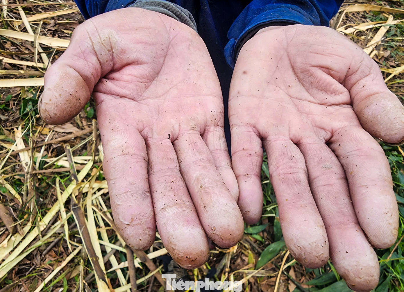 Dù đeo vài lớp tất tay song công việc liên tục, mồ hôi đổ xuống khiến những bàn tay chai sạn, rách ra. Dù đeo vài lớp tất tay song công việc liên tục, mồ hôi đổ xuống khiến những bàn tay chai sạn, rách ra.