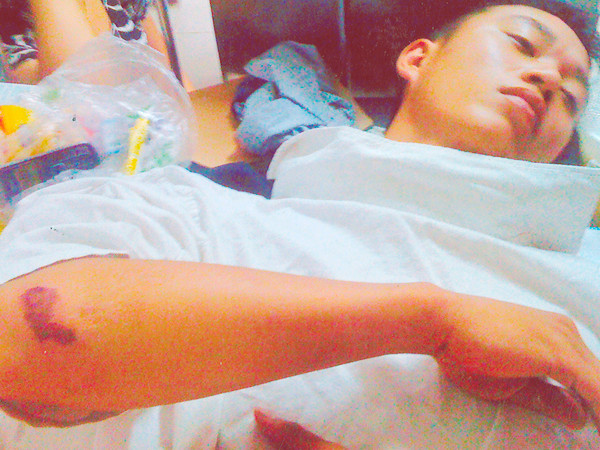 Sinh viên Hiếu điều trị tại bệnh viện Ảnh: P.V