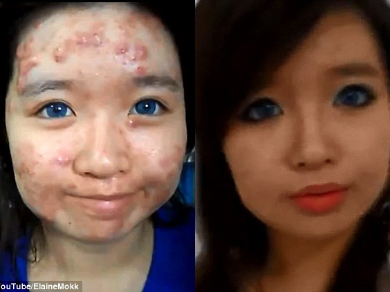Cô gái makeup khuôn mặt mụn thành hotgirl