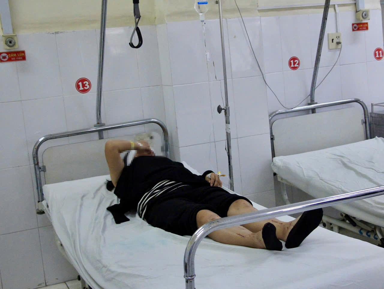 Một nạn nhân đang được cứu chữa tại Bệnh viện Đa khoa tỉnh Khánh Hòa. Một nạn nhân đang được cứu chữa tại Bệnh viện Đa khoa tỉnh Khánh Hòa.